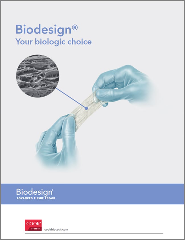Breadth of Offering: SIS & Biodesign Product Portfolio