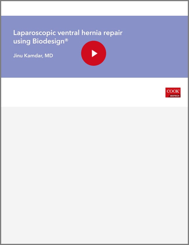 Laparoscopic Ventral Hernia Repair Video (Kamdar)